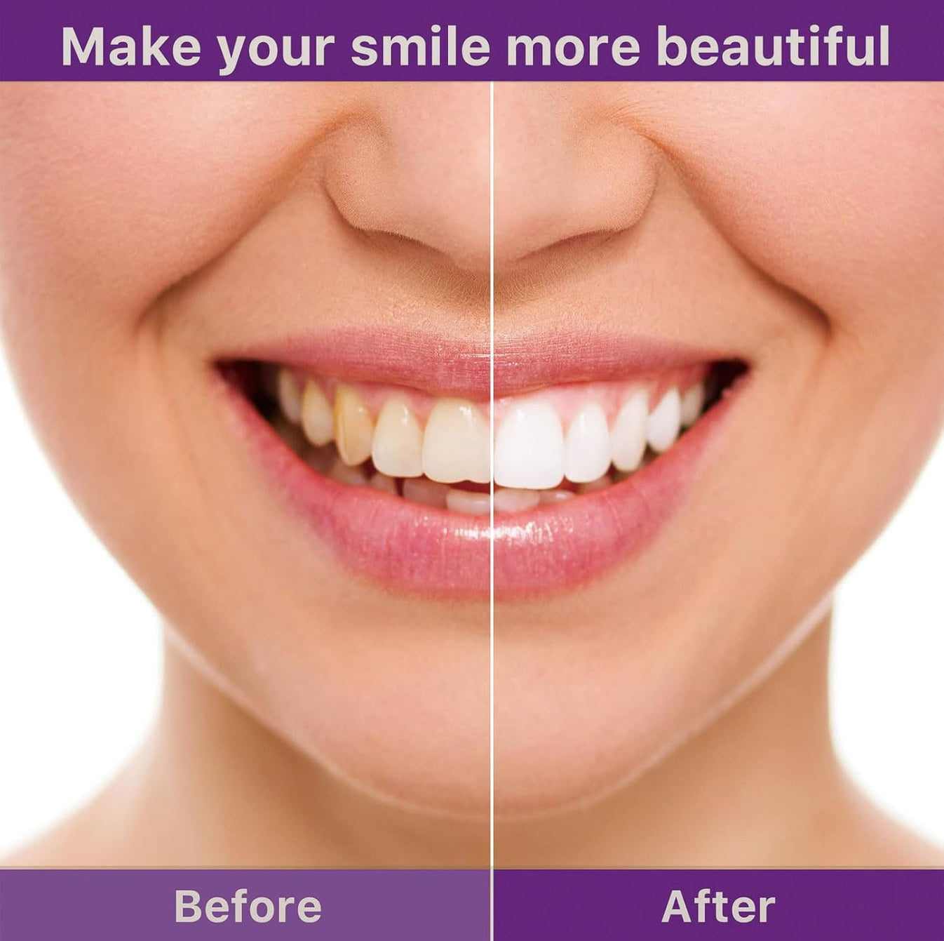 Smile Ease-ابتسامة سهولة
