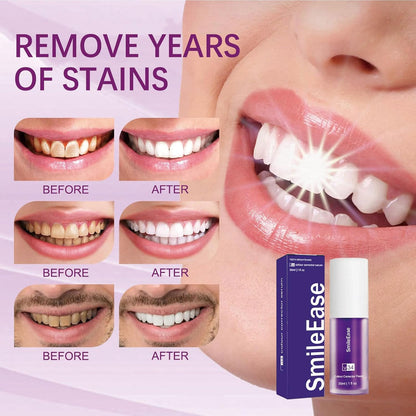Smile Ease-ابتسامة سهولة